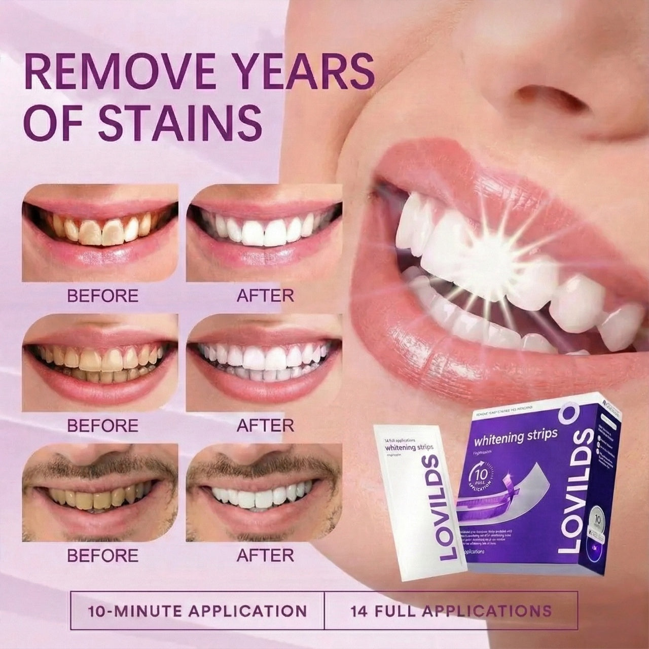LOVILDS Whitening Strips image LOVILDS Whitening Strips